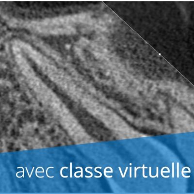 Formation cone beam CT validante (CBCT, radiologie 3D)