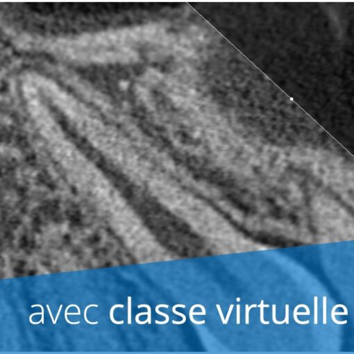 Formation cone beam CT validante (CBCT, radiologie 3D)